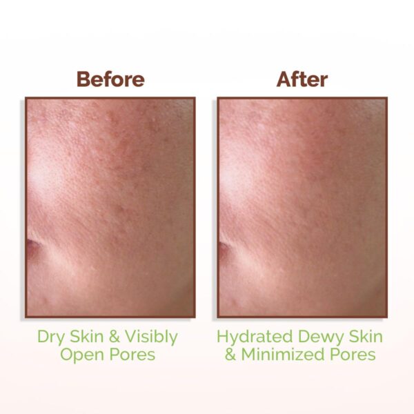 Mamaearth Rice Water Dewy Face Toner 150 ml - Image 6